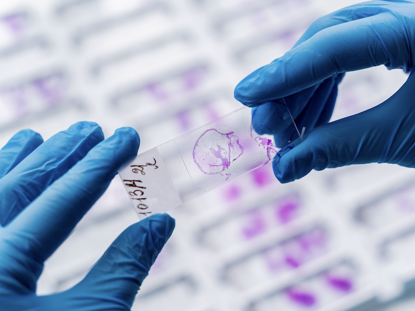 Hands holding histology slides in a lab